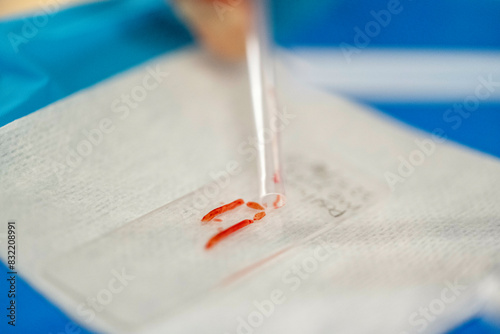 A close-up view of a blood sample being manipulated with tweezers on a white absorbent pad, against a blue background.