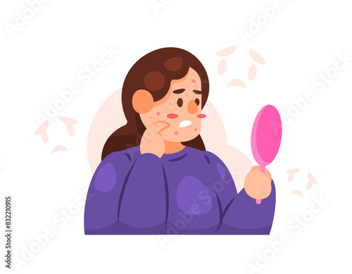 Illustration of a woman who is sad and uncomfortable because of her acne-prone face. feeling ugly because it has a lot of acne. no confidence. look in the mirror. facial skin problems. Character