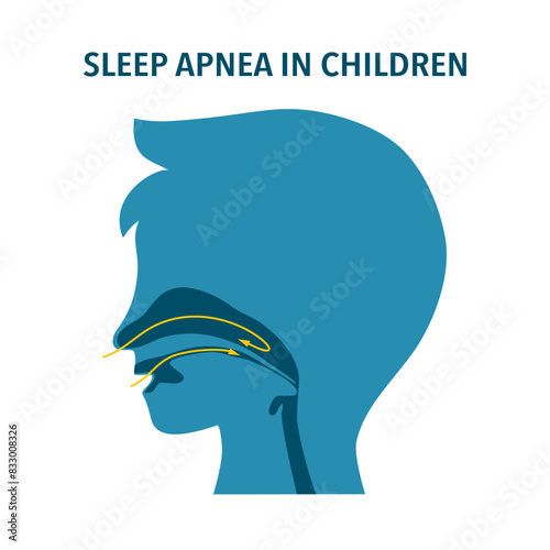Sleep apnea in children concept. Sleep disorder.