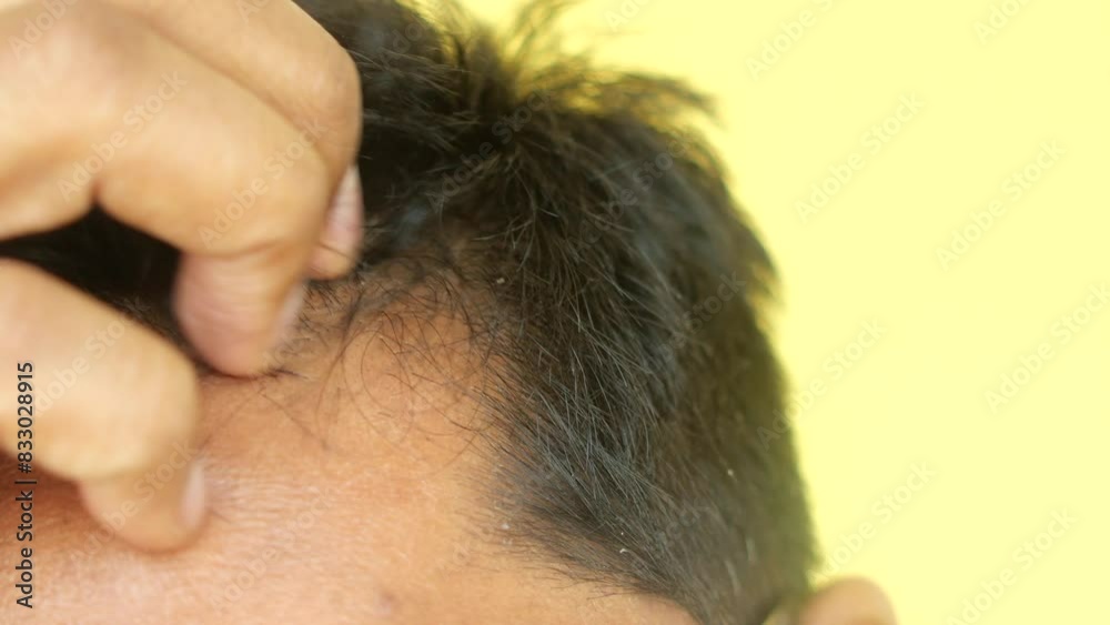hair loss concept with man checking his hair hair loss concept with man checking his hair
