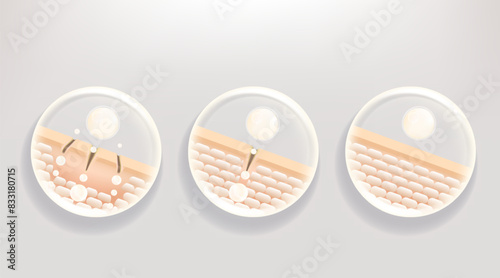 Hyaluronic acid and Niacinamide before and after hair and skin solutions ad, white collagen serum drops into skin cell with cosmetic advertising background ready to use, illustration vector.