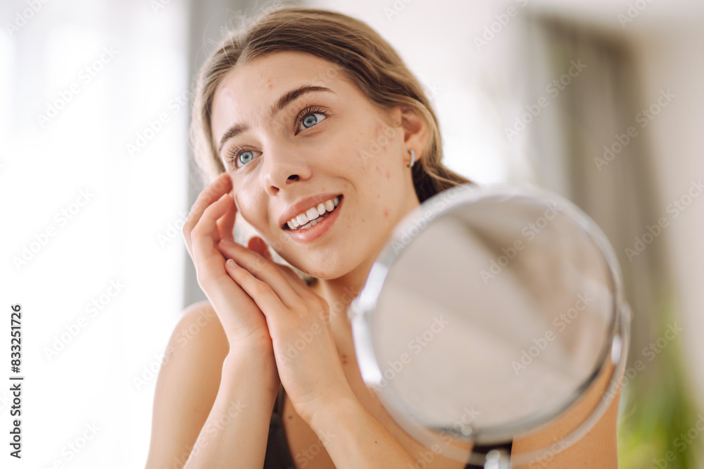 Portrait of a young woman without makeup with Acne skin. Concept of acne therapy, scars, inflammation on face and problem skin. Portrait of a young woman without makeup with Acne skin. Concept of acne therapy, scars, inflammation on face and problem skin.