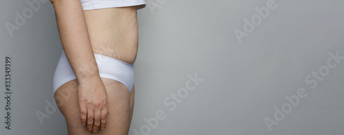 Female belly after pregnancy and childbirth on white background
