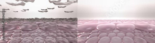 Принти на полотні Skin dry dead cells exfoliation process