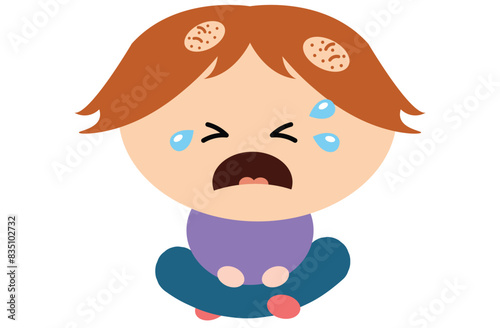 Alopecia areata is an autoimmune condition causing patchy hair loss on the scalp, face, and body. It occurs when the immune system attacks hair follicles, leading to sudden, vector