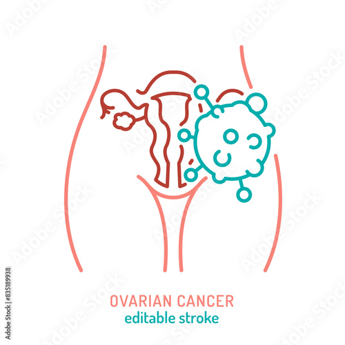 Epithelial ovarian tumor outline icon. Cancer of the ovaries.