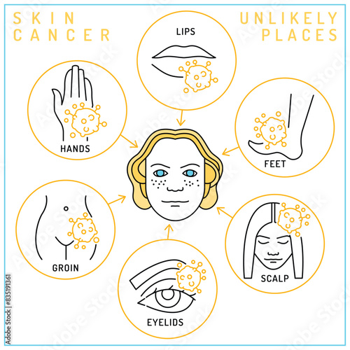 Skin cancer unlikely places. Vertical poster in outline style.