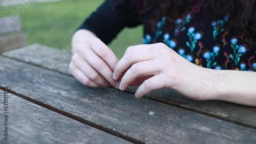 Camera pans nervous, eczema-covered hands at table
