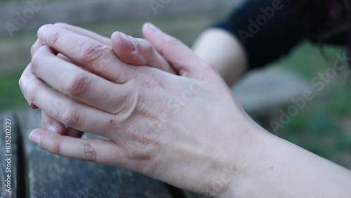 Stressed with eczema, hands fret at table