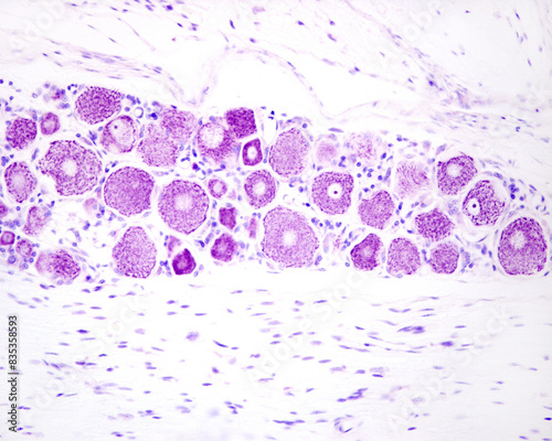 Photos Dorsal root ganglion