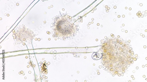 Mold species (Aspergillus sp) under microscope. Fresh sample whithout staining. Stacked image photo