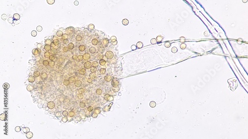 Quadro em tela Mold species (Aspergillus sp) under microscope