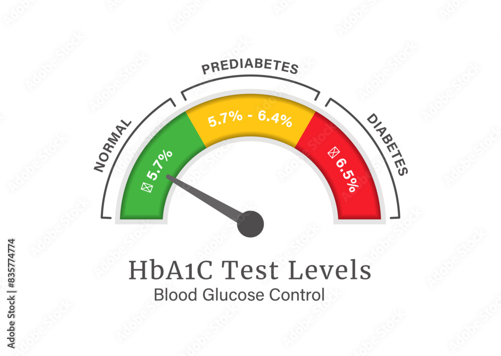 Diabetes Infographic HbA1C Test Levels Range for Blood Glucose Control with Editable Text. Diabetes Infographic HbA1C Test Levels Range for Blood Glucose Control with Editable Text.