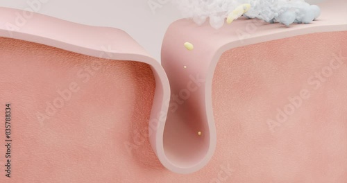 3D-animated video of the process of using cleansing foam and acne treatments. Foam cleanses clogged pores, helps to get rid of acne and inflammation, and prevents the formation of cysts and comedones.