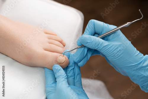 Podiatrist administering treatment for a fungal infection on a womans toenail. 