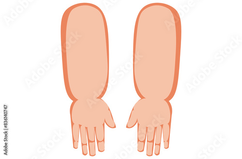 Angioedema is a rapid swelling of the deeper layers of the skin, often triggered by allergies. swelling the hand. It can be life-threatening if untreated,skin