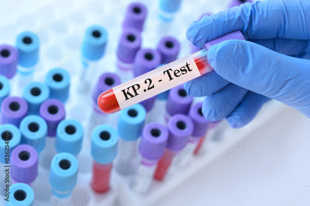 Naklejka premium Doctor holding a test blood sample tube for the detection of the virus KP.2 on the background of medical test tubes. KP.2, one of the FliRT variants. Symptoms with FLiRT are the same as with omicron