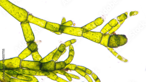 Marine green algae under microscope. The species is probably Cladophora sp. Stacked photo photo