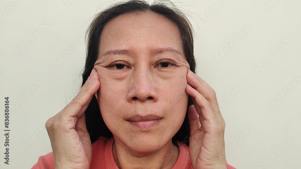 portrait the fingers holding the flabbiness adipose, ache, headache, Flabby skin and loose, ptosis and swelling beside the eyelid,dark spots and blemish on the face of middle aged women 55 years old. portrait the fingers holding the flabbiness adipose, ache, headache, Flabby skin and loose, ptosis and swelling beside the eyelid,dark spots and blemish on the face of middle aged women 55 years old.