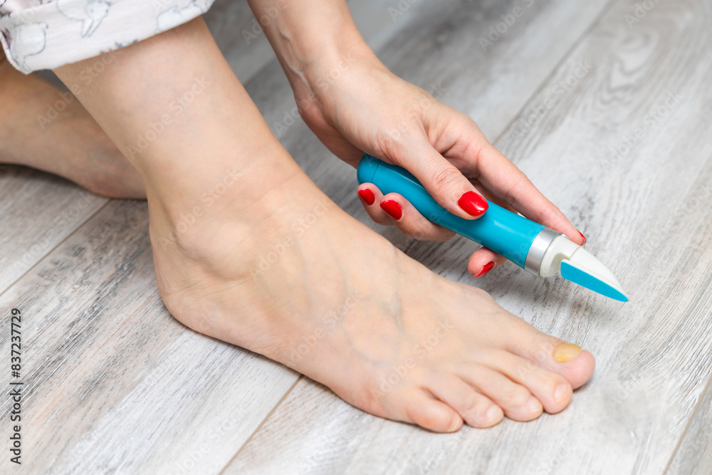 woman sanding her toenails with a sander. nail fungus. toenail disease