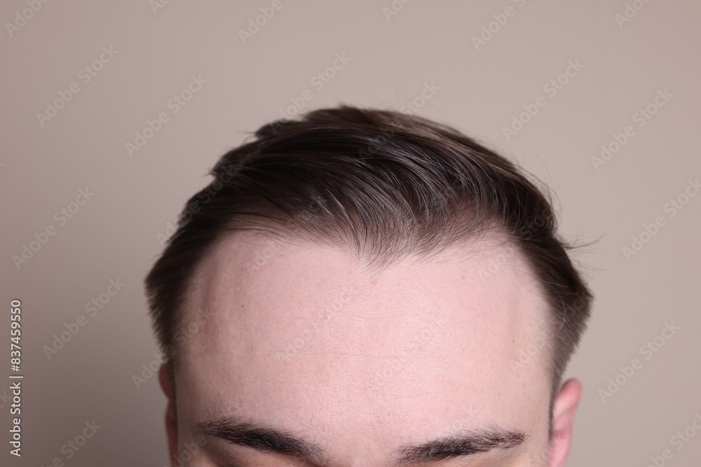 Fototapeta premium Baldness concept. Man with receding hairline on beige background, closeup