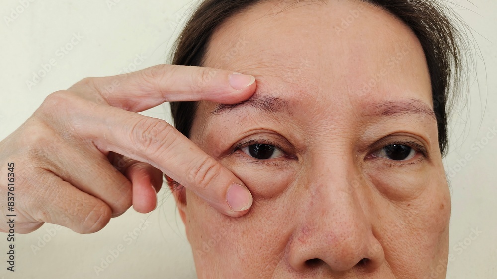 Obraz premium Portrait the flabbiness adipose sagging skin around the eye, ptosis and swelling, dark spots and blemish, loose and freckles of middle aged women 55 years old, health care and beauty concept.