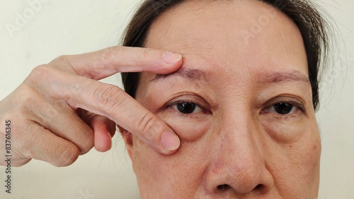 Portrait the flabbiness adipose sagging skin around the eye, ptosis and swelling, dark spots and blemish, loose and freckles of middle aged women 55 years old, health care and beauty concept.