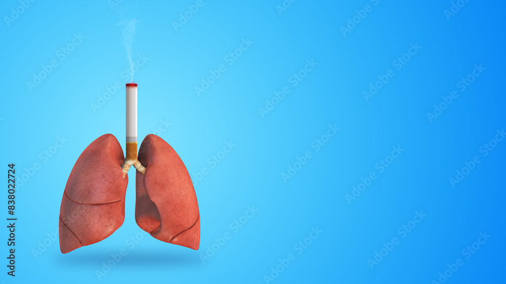 Human lungs damage due to the harmful effects of smoking Human lungs damage due to the harmful effects of smoking