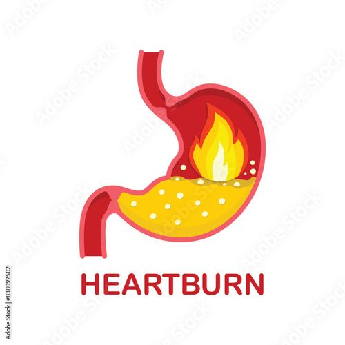 Heartburn, illustration of the stomach with fire, acute burning pain of heartburn.