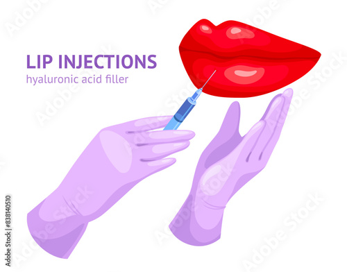 Lip injection. Lips fillers injectables, botox syringe injecting needle injections for sexy woman face plastic volume augmentation in beauty salon, ingenious vector illustration