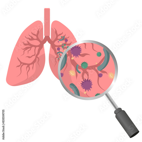 Lungs virus disease 