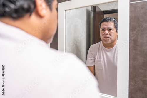 Man with vitiligo standing facing the mirror