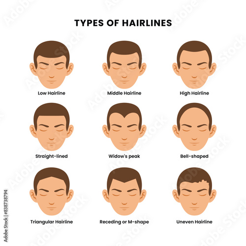 Set different types of hairlines poster with  low, middle, high, straight-lined, widow's peak, bell-shaped,triangular, receding, m-shaped, uneven. Beautiful hairstyle, trendy haircut fashion barber.