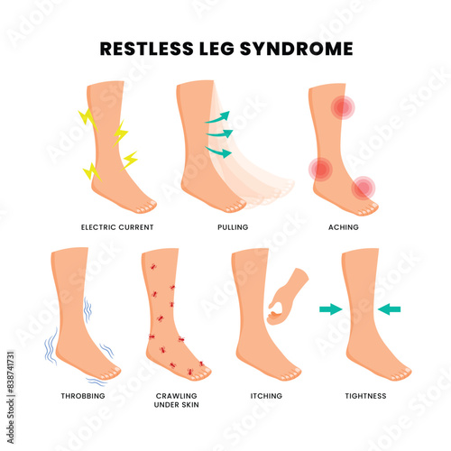 Different types of restless leg syndrome poster, medical banner infographic with electric current, pulling, aching, throbbing, crawling under skin, itching, tightness. Feet foot periodic pain ache.