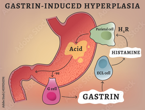 Gastrin-induced hyperplasia. Gastric acid secretion. Gastric motility stimulation. photo