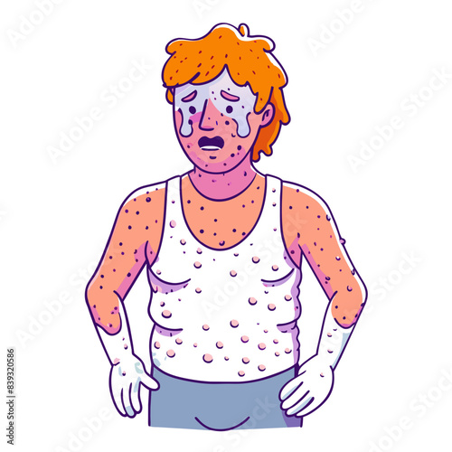 after running, many sweats at underarm, has pimples on face