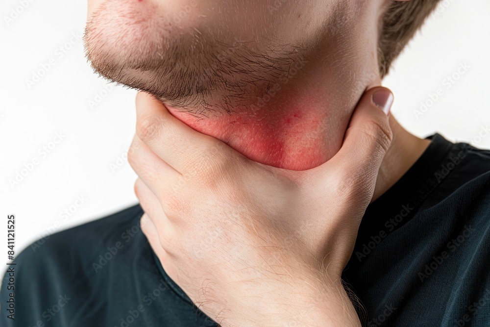 Unhappy man with red rash on his neck experiencing pain and discomfort, medical concept of skin irritation and inflammation Unhappy man with red rash on his neck experiencing pain and discomfort, medical concept of skin irritation and inflammation