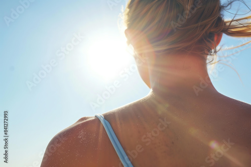 
close up of sunburn on woman's back, blue sky with bright sunshine in background photo