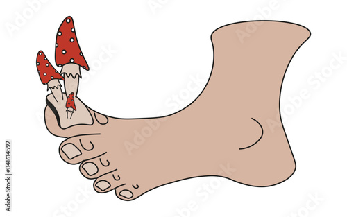 Nail Fungus concept isolated white. Trendy Groovy vector illustration of a foot with Toadstools on the Nail. Flat style Fungal Infection art.