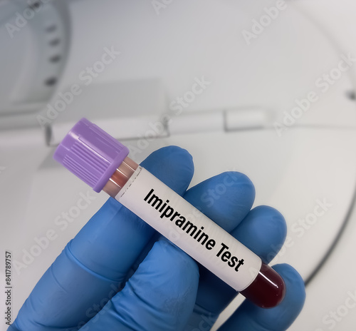 Blood sample for Imipramine and desipramine test, is a tricyclic antidepressant mainly used to the treatment of depression, anxiety and panic disorder photo