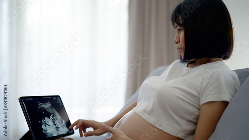 A pregnant woman sits on a couch looking at an ultrasound image of her baby on a tablet screen.
