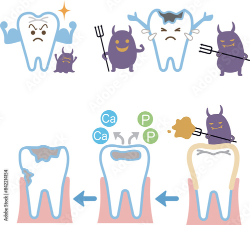 虫歯と戦う歯と虫歯に攻撃されている歯