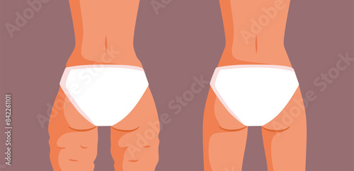 Woman Before and After Body Remodeling Treatment Vector Illustration. Weight lost and sports training result comparison 
