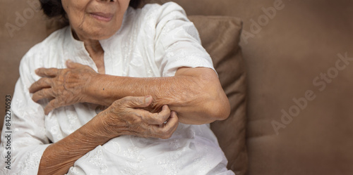 Bild auf Leinwand Elderly woman itchy and scratching arm because dry skin.