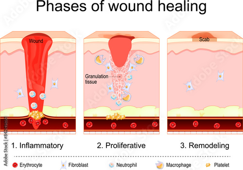 Wound healing process. Tissue repair