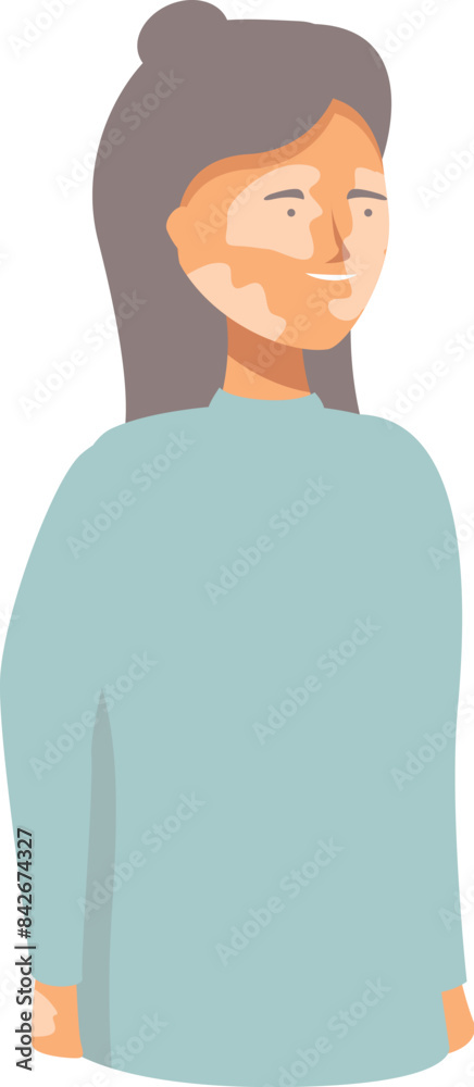 Young woman with vitiligo skin condition smiling and feeling confident Young woman with vitiligo skin condition smiling and feeling confident