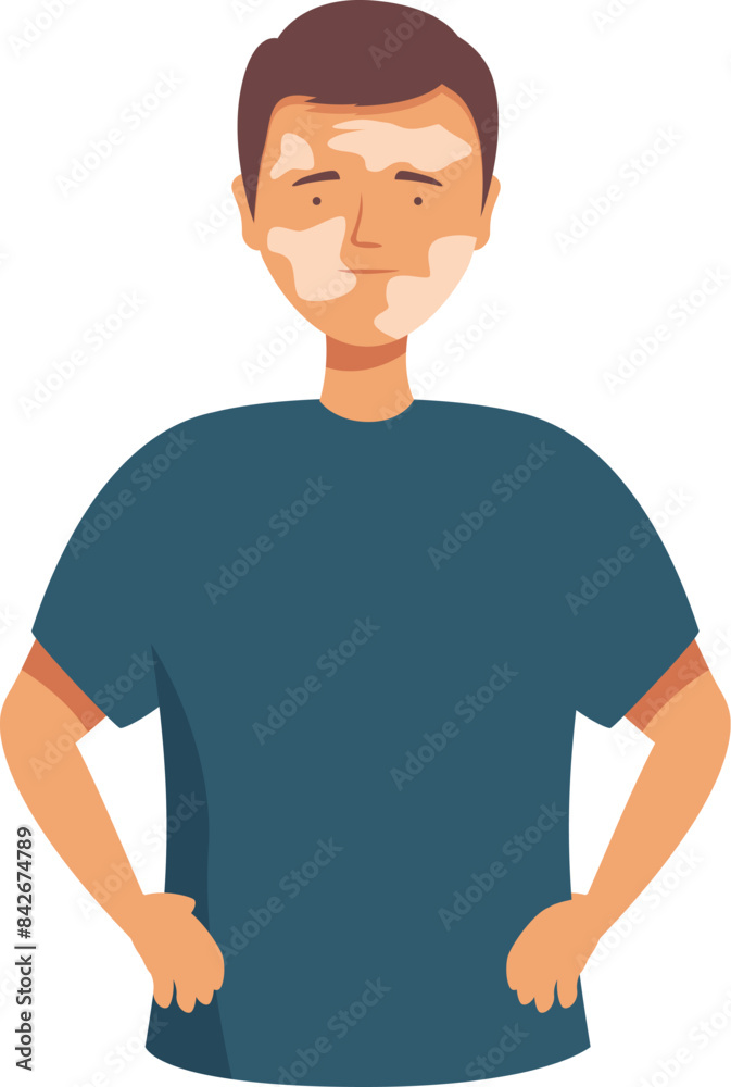 Young man with vitiligo skin condition is posing confidently, embracing his uniqueness and promoting body positivity Young man with vitiligo skin condition is posing confidently, embracing his uniqueness and promoting body positivity