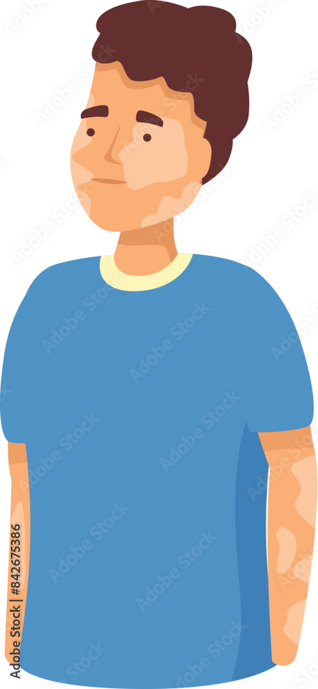 Young man with vitiligo is standing calmly showing his skin pigmentation disease, autoimmune disorder, skin health awareness concept Young man with vitiligo is standing calmly showing his skin pigmentation disease, autoimmune disorder, skin health awareness concept