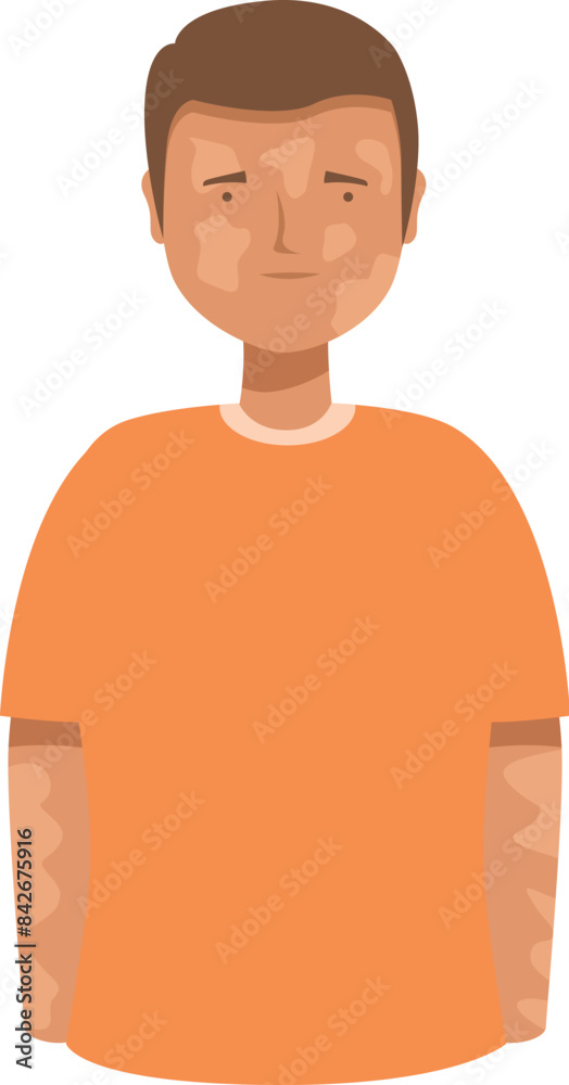 Young man suffering from vitiligo standing with patches on his skin Young man suffering from vitiligo standing with patches on his skin