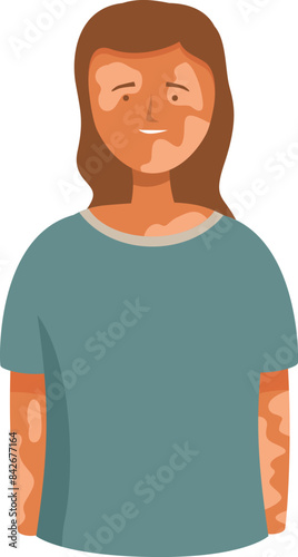 Portrait of a happy female character with vitiligo, promoting body positivity and self acceptance
